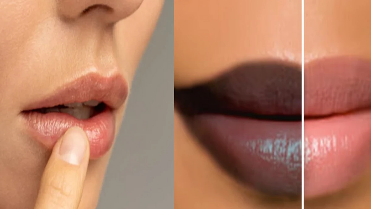 lip darkening around mouth